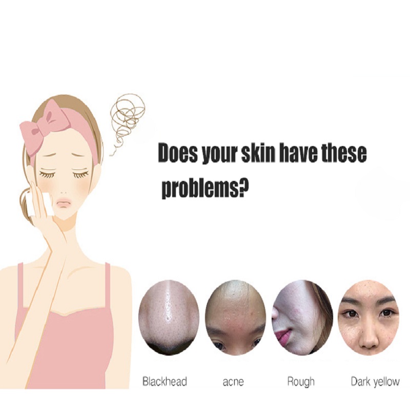 Głębokie oczyszczanie Exfoliators Skin Odmładzanie twarzy Winda twarzy ultradźwiękowa Płuczka skóry