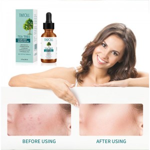 Serum drzewa herbacianego