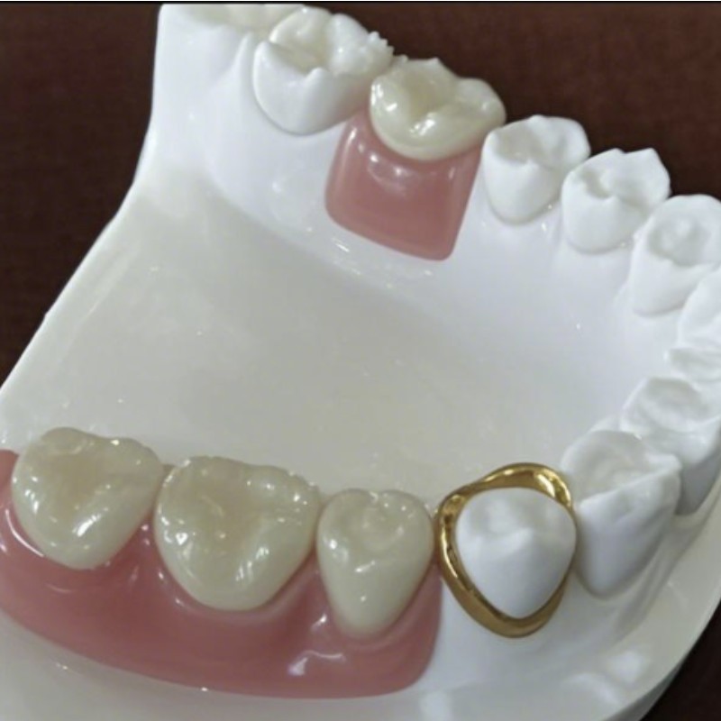 Precyzyjne przywiązanie