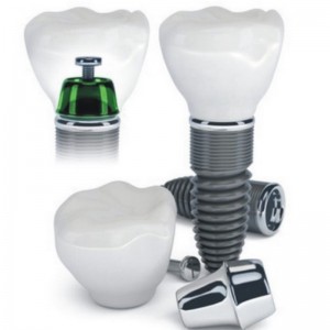 Implant dentystyczny